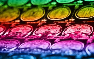 Spotting the signs of acquired brain injury (ABI) in adults