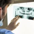 Close-up of dentist looking at dental x-ray plate