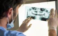 Close-up of dentist looking at dental x-ray plate